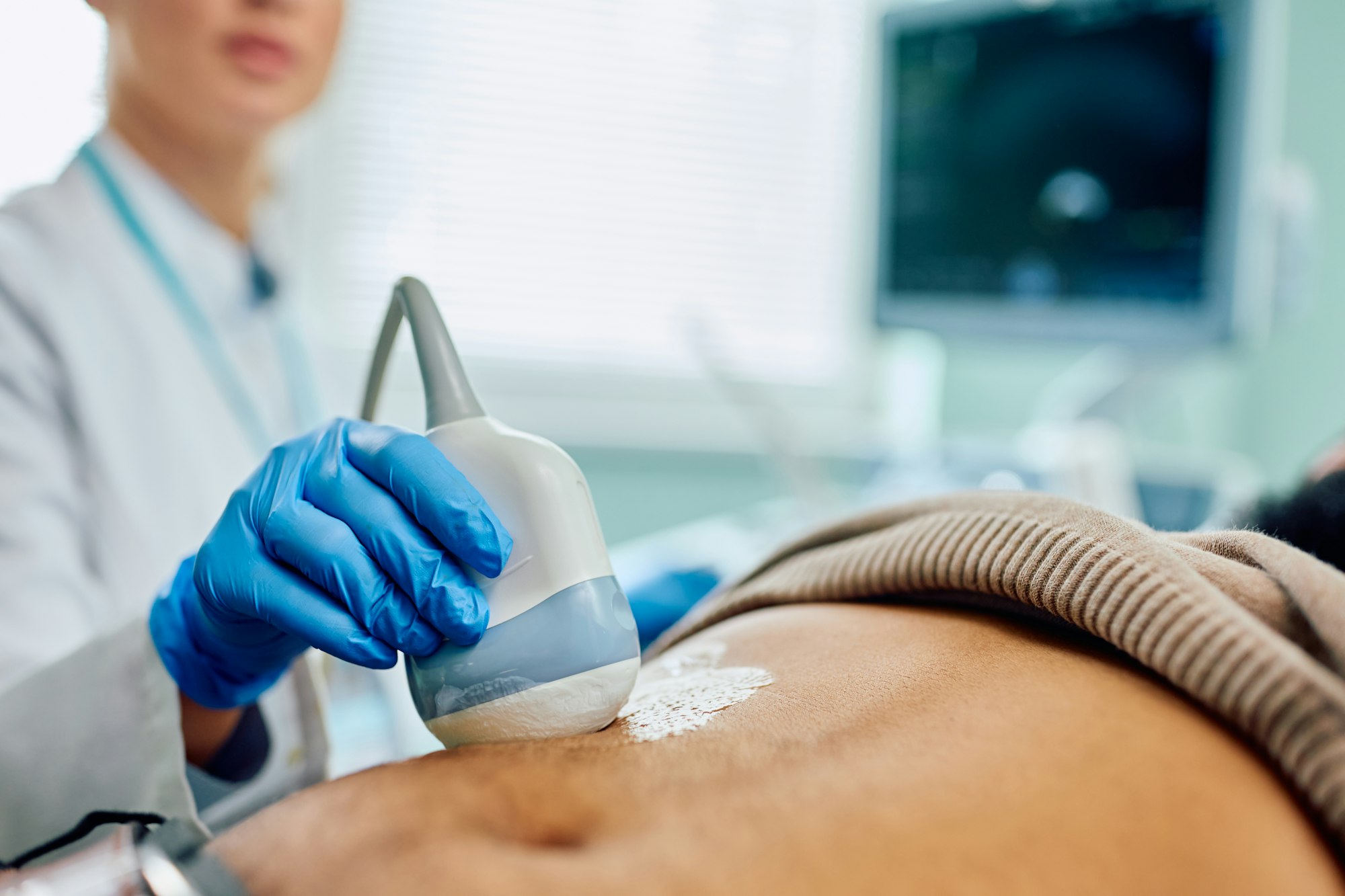 Close up of doctor using ultrasound while examining black man's abdomen.